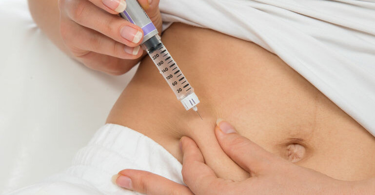 Frau setzt sich einen Insulin-Pen an eine Bauchfalte