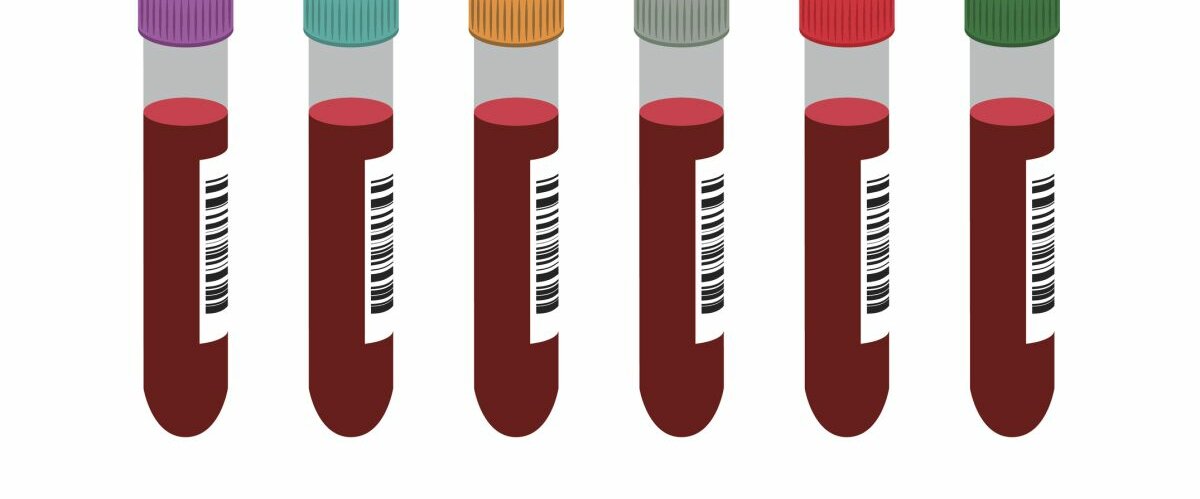 Blutproben Zeichnung mehrerer aufgereihter Blutproben