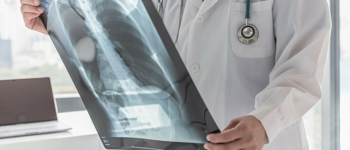 Arzt hält Röntgenbild.
