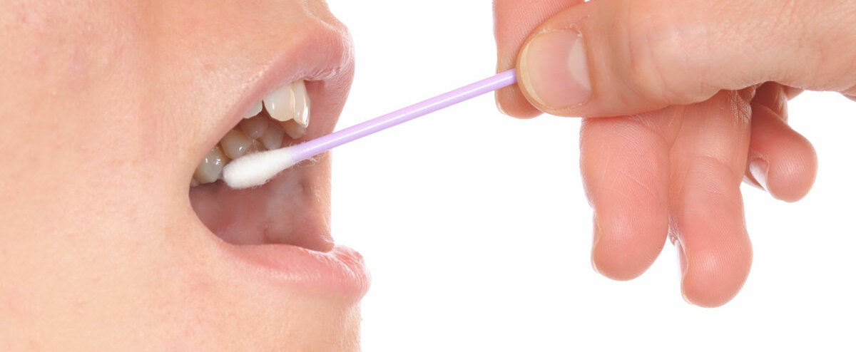 Mit einem Wattestäbchen wird ein Abstrich im Mund gemacht