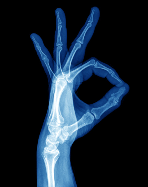 Röntgenbild Hand © akesak / iStock / Getty Images